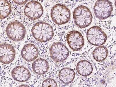 Immunohistochemistry-Paraffin: SELENBP1 Antibody [NBP2-97662] - Immunochemical staining of human SELENBP1 in human colon with rabbit polyclonal antibody at 1:100 dilution, formalin-fixed paraffin embedded sections.