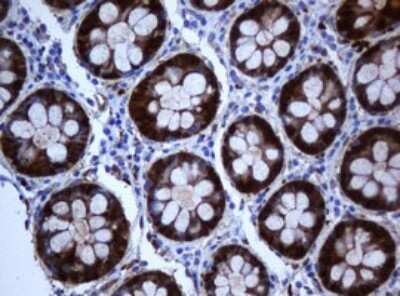 Immunohistochemistry: SELENBP1 Antibody (OTI3H1) - Azide and BSA Free [NBP2-74053] - Analysis of Human colon tissue. (Heat-induced epitope retrieval by 10mM citric buffer, pH6.0, 120C for 3min)