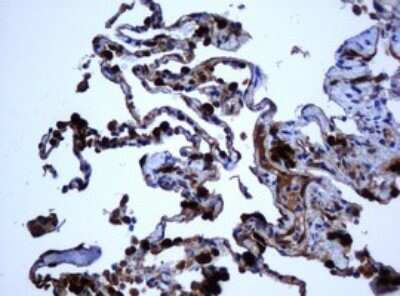 Immunohistochemistry: SELENBP1 Antibody (OTI3H1) - Azide and BSA Free [NBP2-74053] - Analysis of Human lung tissue. (Heat-induced epitope retrieval by 10mM citric buffer, pH6.0, 120C for 3min)