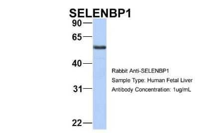 Western Blot: SELENBP1 Antibody [NBP1-55263] - Sample Type: Human Fetal Liver Antibody Dilution: 1.0 ug/ml