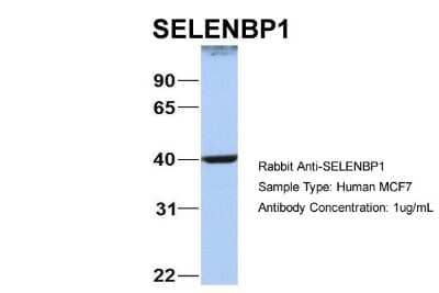 Western Blot: SELENBP1 Antibody [NBP1-55263] - Sample Type: MCF7 Antibody Dilution: 1.0 ug/ml SELENBP1 is supported by BioGPS gene expression data to be expressed in MCF7