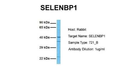 Western Blot: SELENBP1 Antibody [NBP1-55263] - Sample Tissue: Human 721_B Antibody Dilution: 1.0 ug/ml