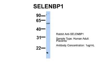 Western Blot: SELENBP1 Antibody [NBP1-55263] - Sample Type: Human Adult Placenta Antibody Dilution: 1.0 ug/ml