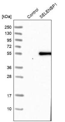 Western Blot: SELENBP1 Antibody [NBP1-83197] - Analysis in control (vector only transfected HEK293T lysate) and SELENBP1 over-expression lysate (Co-expressed with a C-terminal myc-DDK tag (3.1 kDa) in mammalian HEK293T cells).