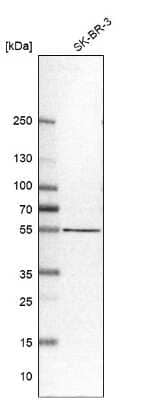 Western Blot: SELENBP1 Antibody [NBP1-83197] - Analysis in human cell line SK-BR-3.