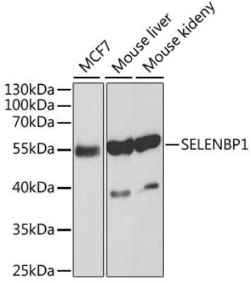 Western Blot: SELENBP1 Antibody [NBP3-03603] - Analysis of extracts of various cell lines, using SELENBP1 antibody at 1:1000 dilution. Secondary antibody: HRP Goat Anti-Rabbit IgG (H+L) at 1:10000 dilution. Lysates/proteins: 25ug per lane. Blocking buffer: 3% nonfat dry milk in TBST. Detection: ECL Basic Kit.