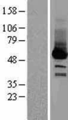 Western Blot: SELENBP1 Overexpression Lysate (Adult Normal) [NBL1-15791] Left-Empty vector transfected control cell lysate (HEK293 cell lysate); Right -Over-expression Lysate for SELENBP1.