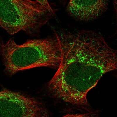 Immunocytochemistry/Immunofluorescence: SELRC1 Antibody [NBP1-87392] - Immunofluorescent staining of human cell line U-2 OS shows localization to nucleus & mitochondria.
