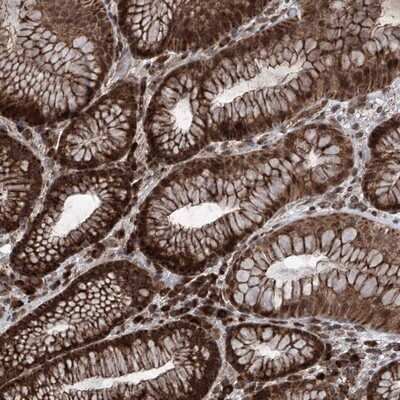 Immunohistochemistry-Paraffin: SELRC1 Antibody [NBP1-87392] - Staining of human stomach shows strong cytoplasmic and nuclear positivity in glandular cells.