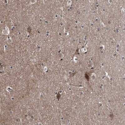Immunohistochemistry-Paraffin: SELRC1 Antibody [NBP1-87392] - Staining of human cerebral cortex shows moderate to strong cytoplasmic positivity in neurons.
