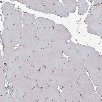 Immunohistochemistry-Paraffin: SELRC1 Antibody [NBP1-87392] - Staining of human skeletal muscle shows no positivity in myocytes as expected.