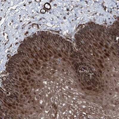 Immunohistochemistry-Paraffin: SELRC1 Antibody [NBP1-87393] - Staining of human esophagus shows strong cytoplasmic and nuclear positivity in squamous epithelial cells.