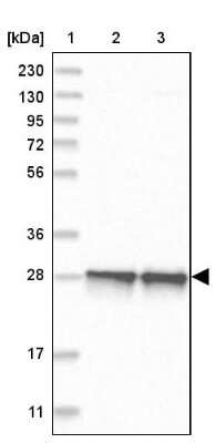 Western Blot: SELRC1 Antibody [NBP1-87392] - Lane 1: Marker  [kDa] 230, 130, 95, 72, 56, 36, 28, 17, 11.  Lane 2: Human cell line RT-4.  Lane 3: Human cell line U-251MG sp