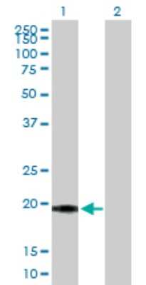 Western Blot: SELS Antibody [H00055829-D01P] - Analysis of SELS expression in transfected 293T cell line by SELS polyclonal antibody.Lane 1: SELS transfected lysate(21.00 KDa).Lane 2: Non-transfected lysate.
