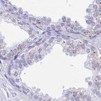 Immunohistochemistry: SELV Antibody [NBP2-32446] - Staining of prostate.