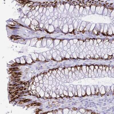 Immunohistochemistry: SELV Antibody [NBP2-32446] - Staining of human rectum shows strong cytoplasmic positivity in goblet cells.
