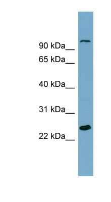 Western Blot: SEMA3D Antibody [NBP1-59505] - THP-1 cell lysate, concentration 0.2-1 ug/ml.