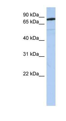 Western Blot: SEMA4B Antibody [NBP1-62242] - Human Brain lysate, concentration 0.2-1 ug/ml.