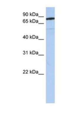 Western Blot: SEMA4B Antibody [NBP1-69276] - This Anti-SEMA4B antibody was used in Western Blot of Fetal Brain tissue lysate at a concentration of 1ug/ml.