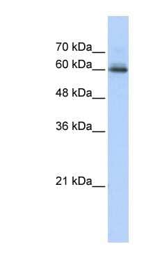 Western Blot: SEMA4F Antibody [NBP1-59942] - Transfected 293T cell lysate, concentration 0.2-1 ug/ml.
