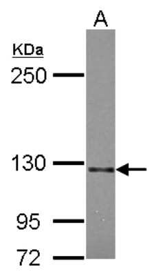 Western Blot: Semaphorin 5A Antibody [NBP2-20291] - Sample (30 ug of whole cell lysate) A: U87-MG 5% SDS PAGE gel, diluted at 1:2000.