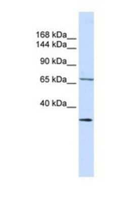 Western Blot: SEMA6D Antibody [NBP1-69274] - This Anti-SEMA6D antibody was used in Western Blot of 721_B tissue lysate at a concentration of 1ug/ml.