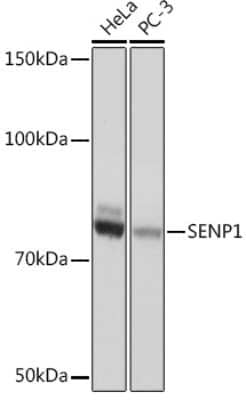 Western Blot: SENP1 Antibody (1C3I4) [NBP3-16417] - Western blot analysis of extracts of various cell lines, using SENP1 Rabbit mAb (NBP3-16417) at 1:1000 dilution. Secondary antibody: HRP Goat Anti-Rabbit IgG (H+L) at 1:10000 dilution. Lysates/proteins: 25ug per lane. Blocking buffer: 3% nonfat dry milk in TBST. Detection: ECL Basic Kit. Exposure time: 1s.