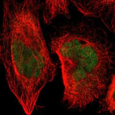 Immunocytochemistry/Immunofluorescence: SENP1 Antibody [NBP1-89553] - Immunofluorescent staining of human cell line A-431 shows localization to nucleus.