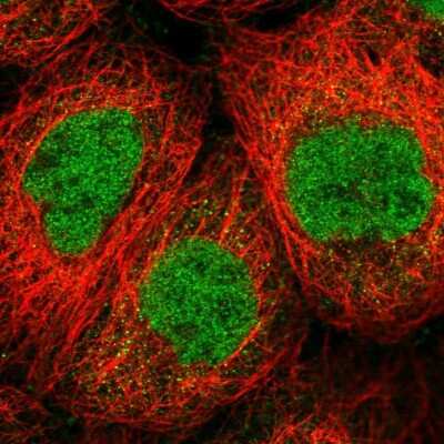 Immunocytochemistry/Immunofluorescence: SENP1 Antibody [NBP2-55420] - Staining of human cell line A-431 shows localization to nucleoplasm.