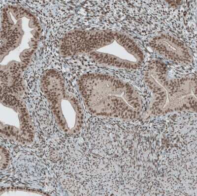 Immunohistochemistry-Paraffin: SENP1 Antibody [NBP1-89553] - Staining of human endometrium shows moderate nuclear positivity in glandular cells.