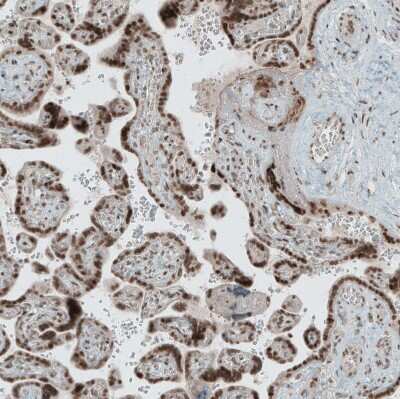 Immunohistochemistry-Paraffin: SENP1 Antibody [NBP1-89553] - Staining of human placenta shows moderate to strong nuclear positivity in trophoblastic cells.