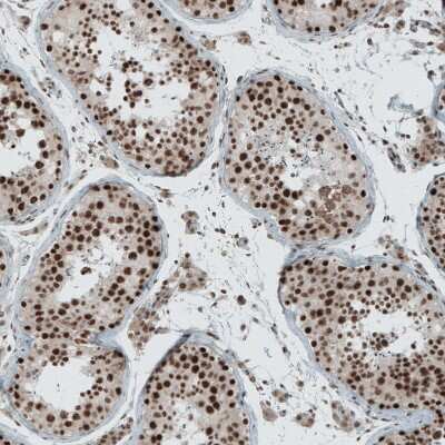 Immunohistochemistry-Paraffin: SENP1 Antibody [NBP1-89553] - Staining of human testis shows moderate to strong nuclear positivity in cells in seminiferous ducts.