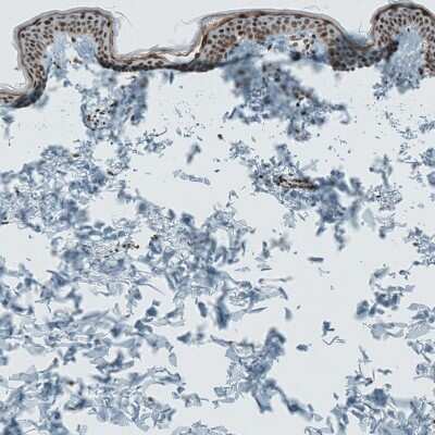 Immunohistochemistry-Paraffin: SENP1 Antibody [NBP1-89553] - Staining of human skin shows moderate to strong nuclear positivity in keratinocytes.