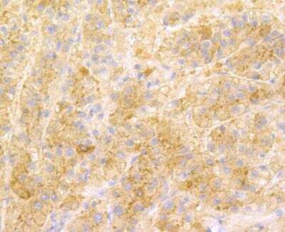 Immunohistochemistry: SENP1 Antibody (JG37-79) [NBP2-76867] - Immunohistochemical analysis of paraffin-embedded human liver tissue using anti-SENP1 antibody. Counter stained with hematoxylin.