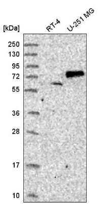 Western Blot: SENP1 Antibody [NBP2-55420] - Analysis in human cell line RT-4 and human cell line U-251 MG.