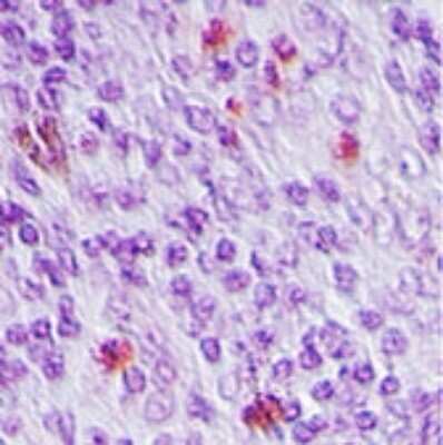 Immunohistochemistry-Paraffin: SENP2 Antibody [NB100-56406] - analysis of SENP2 in human breast tissue using SENP2 antibody at 5 ug/ml.