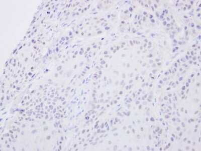 Immunohistochemistry-Paraffin: SENP2 Antibody [NBP1-31217] - Cal27 xenograft, using SENP2 antibody at 1:500 dilution. Antigen Retrieval: Trilogy™ (EDTA based, pH 8.0) buffer, 15min. 