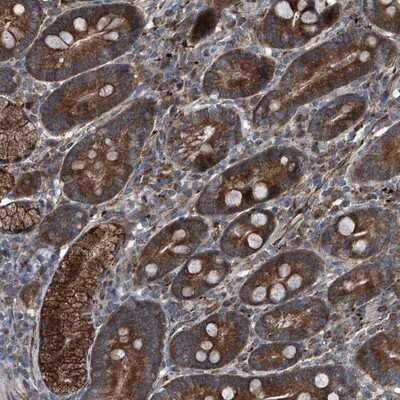 Immunohistochemistry-Paraffin: SENP2 Antibody [NBP1-88919] - Staining of human duodenum shows strong cytoplasmic positivity in glandular cells.