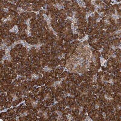 Immunohistochemistry-Paraffin: SENP2 Antibody [NBP1-88920] - Staining of human pancreas shows strong cytoplasmic positivity in exocrine glandular cells.