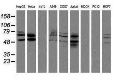 Western Blot: SENP2 Antibody (OTI3D3) - Azide and BSA Free [NBP2-74062] - Analysis of extracts (35ug) from 9 different cell lines by using g anti-SENP2 monoclonal antibody (HepG2: human; HeLa: human; SVT2: mouse; A549: human; COS7: monkey; Jurkat: human; MDCK: canine; PC12: rat; MCF7: human).