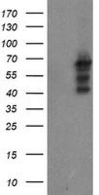 Western Blot: SENP2 Antibody (OTI3D3) - Azide and BSA Free [NBP2-74062] - HEK293T cells were transfected with the pCMV6-ENTRY control (Left lane) or pCMV6-ENTRY SENP2 (Right lane) cDNA for 48 hrs and lysed. Equivalent amounts of cell lysates (5 ug per lane) were separated by SDS-PAGE and immunoblotted with anti-SENP2.