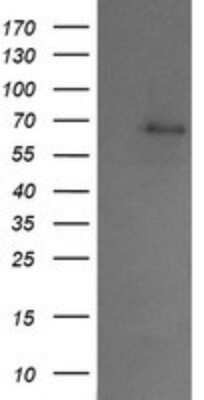 Western Blot: SENP2 Antibody (OTI4B3) - Azide and BSA Free [NBP2-74060] - Analysis of HEK293T cells were transfected with the pCMV6-ENTRY control (Left lane) or pCMV6-ENTRY SENP2.