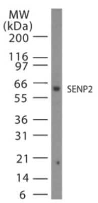 Western Blot: SENP2 Antibody [NB100-56406] - Western blot analysis of SENP2 in 15 ugs of Jurkat cell lysate at 1:1000.
