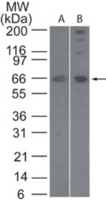 Western Blot: SENP2 Antibody [NB100-56406] - analysis of SENP2 in human Jurkat (A) and mouse NIH 3T3 (B) cell lysate using SENP2 antibody at 3 ug/ml.