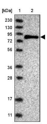 Western Blot: SENP2 Antibody [NBP1-88919] - Lane 1: Marker  [kDa] 230, 130, 95, 72, 56, 36, 28, 17, 11.  Lane 2: Human cell line RT-4.