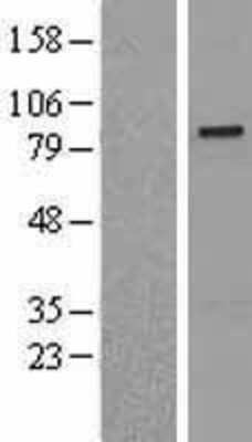 Western Blot: SENP5 Overexpression Lysate (Adult Normal) [NBL1-15811] Left-Empty vector transfected control cell lysate (HEK293 cell lysate); Right -Over-expression Lysate for SENP5.