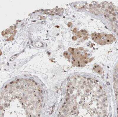 Immunohistochemistry-Paraffin: SENP6 Antibody [NBP1-82958] - Staining of human testis shows strong nuclear positivity in Leydig cells.
