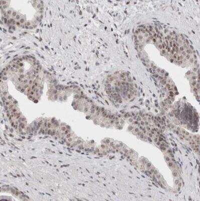 Immunohistochemistry-Paraffin: SENP6 Antibody [NBP1-82958] - Staining of human prostate shows weak positivity in nucleoli in glandular cells.
