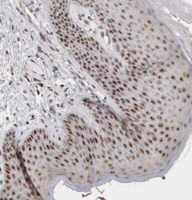 Immunohistochemistry-Paraffin: SENP6 Antibody [NBP1-82958] - Staining of human skin shows strong positivity in nucleoli in squamous epithelial cells.