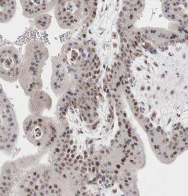Immunohistochemistry-Paraffin: SENP6 Antibody [NBP1-82958] - Staining of human placenta shows moderate nuclear positivity in trophoblastic cells.